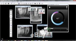 2014 y Kodak Carestream 6100 size 1 X-ray RVG Sensor dental TESTED working