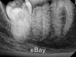 2014y Kodak Carestream 6100 #2 X-ray RVG Software Sensor dental TESTED working