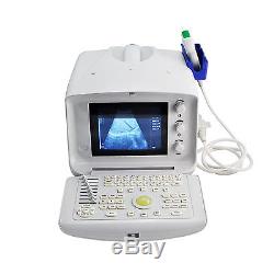 2016 NEW A Portable Ultrasound Scanner w Convex probe used in hospital clinic 3D