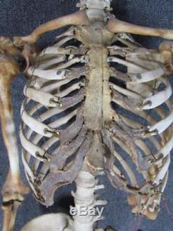 AUTHENTIC ANTIQUE Anatomical HUMAN SKELETON DISPLAY MODEL for MEDICAL SCIENCE