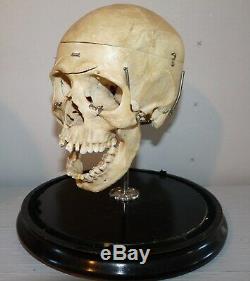 Antique Darwin L Platt Real Human Skull Medical Dental Teaching Rochester NY