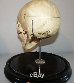 Antique Darwin L Platt Real Human Skull Medical Dental Teaching Rochester NY