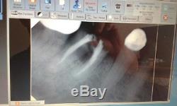 Dental digital x-ray sensor