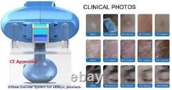 FDA Home Use 308nm Excimer System Beauty Medical Equipment Skincare