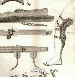 French Medical Manual 1815 Bandages, Equipment & Operations