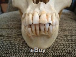 HUMAN SKULL Dental Medical study
