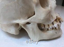 Human Skull Anatomical Medical/dental Teaching In Good Condition