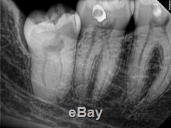 Kodak Carestream 5100 #2 X-ray RVG Software Sensor dental imaging with warranty