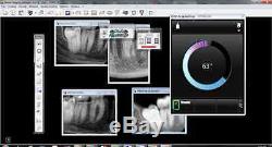 Kodak Carestream 6100 #1 X-ray RVG Software Sensor dental used With Warranty! UK