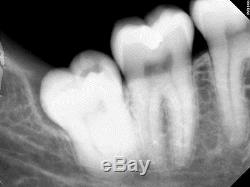 Kodak Carestream 6100 #2 X-ray RVG Software Sensor dental not dexis Röntgen auct