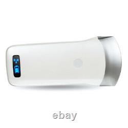Medical Use Wireless Convex Array Ultrasound Probe Portable Scanner Equipment