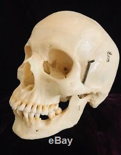 REAL Human Skull used for Medical Dental Teaching Training or Movie Prop