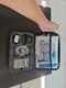 RS Medical Tens Device
