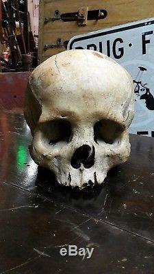 Real Human Skull Medical/ Dental Teaching/Training