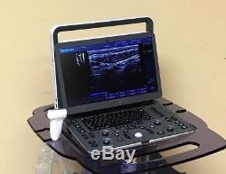 SonoScape Newest E1 Portable Ultrasound Machine with Linear Array Probe