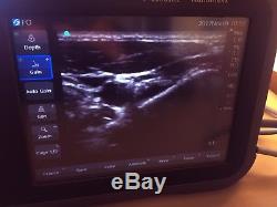 Sonosite Nanomaxx Portable Ultrasound Fully Loaded with Cardiac and Linear Probes