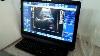 Sonostar New Laptop Pc Protable Used Medical Equipment Ultrasound Images Convex Probe Show Demo