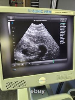 ULTRASONIX Bio SONIC WAVE Ultrasound Machine