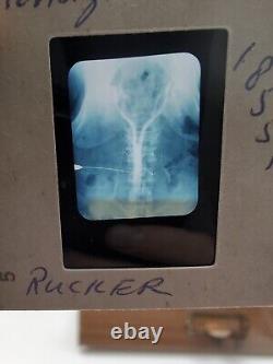 Vintage Photo Slides Kodachrome Pathology Radiology X-ray Medical Education 1950