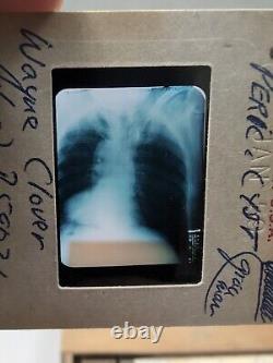 Vintage Photo Slides Kodachrome Pathology Radiology X-ray Medical Education 1950