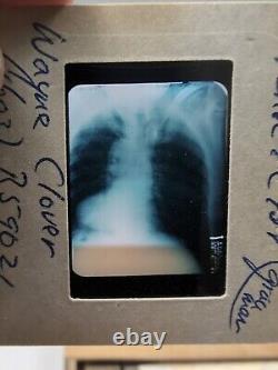 Vintage Photo Slides Kodachrome Pathology Radiology X-ray Medical Education 1950