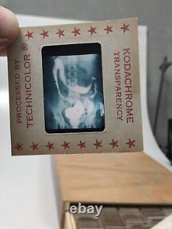 Vintage Photo Slides Kodachrome Pathology Radiology X-ray Medical Education 1950