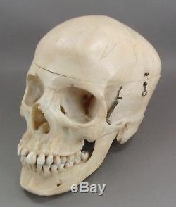 Vtg Skull Genuine Human Bone Vintage Anatomical Medical Student Dental Learning