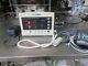 Welch Allyn 52000 Series Vital Signs Monitor with accessories
